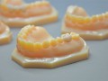 Stratasys 3D 打印機優化義齒製作