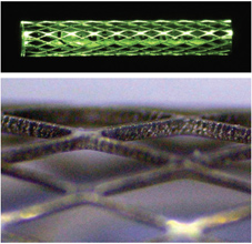 鎳鈦合金微型支架原型的筋寬約為(wei) 20微米,筋厚為(wei) 80微米
