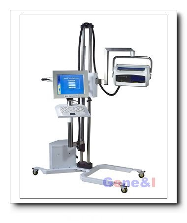 激光多普勒點掃描成像係統