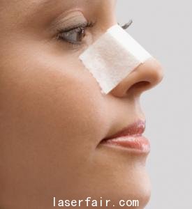 激光美白柔嫩肌膚的方法是什麽(me) 