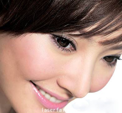 南京激光去紅血絲(si) 