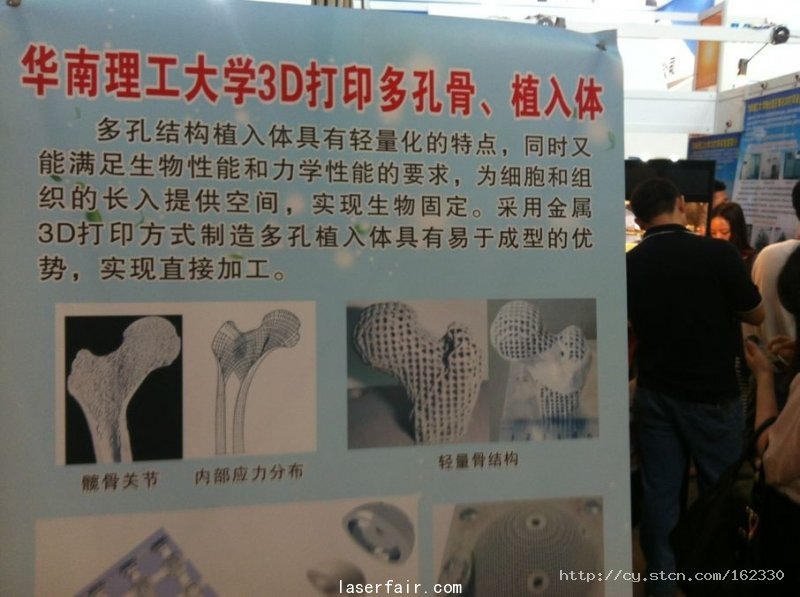 創業(ye) 板上市公司金運激光的激光雕塑產(chan) 品，先用繡花技術弄好再根據激光打印出來的，主要用於(yu) 婚紗和高檔服飾。