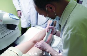 中山醫世界頂級激光 輕鬆修複疤痕