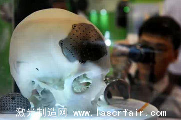 清華x-lab創業(ye) 團隊AOD斬獲醫療領域千萬(wan) 級訂單,3D打印應用迎來突破 3D打印機,3D打印技術,3D打印應用,3D沙蟲網